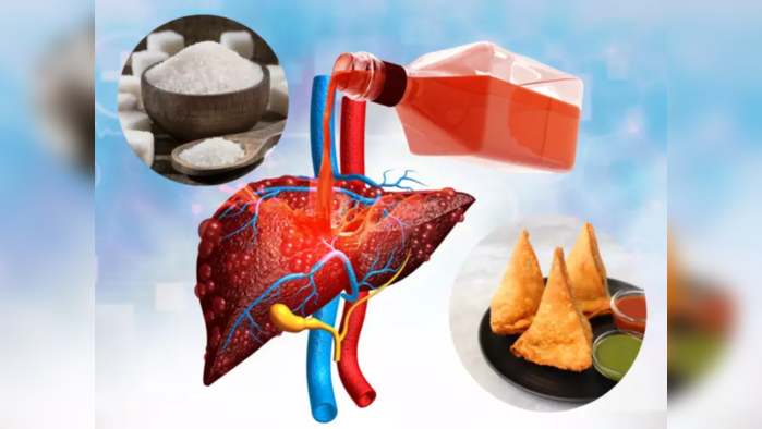 Harmful Foods For Liver: दारूपेक्षा महाभयंकर हे 9 पदार्थ, लिव्हर व आतड्याच्या उडतात चिंधड्या, ताबडतोब खाणं सोडा