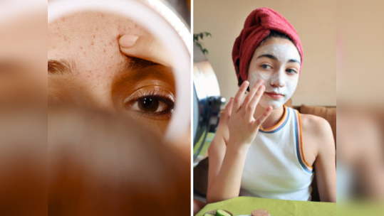 Teenage Skin Care: नुकतेच तारूण्यात केलंय पदार्पण, चेहऱ्यावर नैसर्गिक चमक आणण्यासाठी वापरा ५ टिप्स