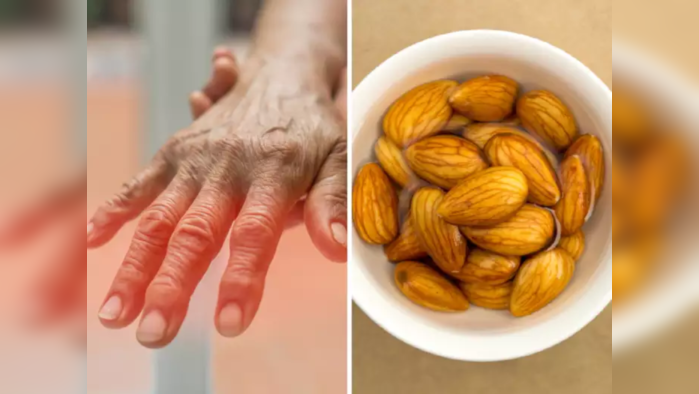 Neuropathy Diet: हातापायात येतायत भयंकर मुंग्या? वेदनांनी चालणं व काम करणं झालंय मुश्किल? खायला घ्या हे पदार्थ