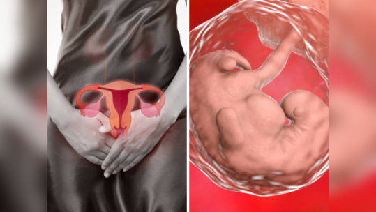 Prolapsed Uterus: त्रासदायक शारीरिक संबंध आणि बद्धकोष्ठतेमुळे योनीबाहेर येते गर्भाशय, काय आहे नक्की प्रकार