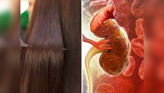 Hair Straightening मुळे 26 वर्षाच्या मुलीचे किडनी डॅमेज, केमिकलच्या संपर्कात येणे धोकादायक