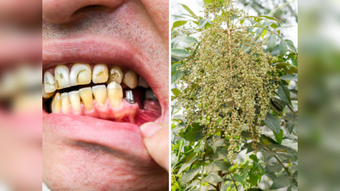दातांचा पिवळेपणा, कीड, तोंडाची दुर्गंधी मुळापासून उपटून काढेल चायनीज वनस्पती, दुधासारखे चमकतील दात