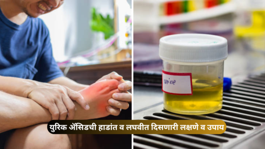 लघवीला फेस येतो? हातापायांना मुंग्या येतात? सांध्यात जमा घाणेरडे Uric Acid जाईल उडून, हे उपाय देतील क्षणात आराम