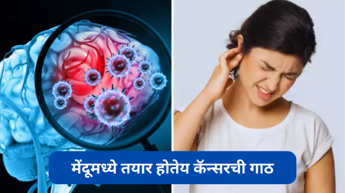 World Brain Tumor Day: मेंदू पोखरून काढतेय कॅन्सरची गाठ, हे लक्षण दिसल्यास थेट हॉस्पिटलमध्ये धाव घ्या