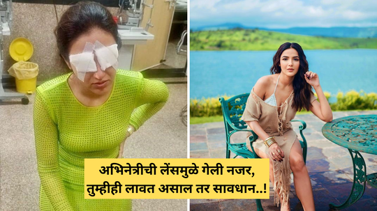 लेंस लावल्यामुळे अभिनेत्रीच्या डोळ्यांना गंभीर दुखापत, करू नका या 10 चुका, नजर गेल्यावर Jasmin Bhasin म्हणाली