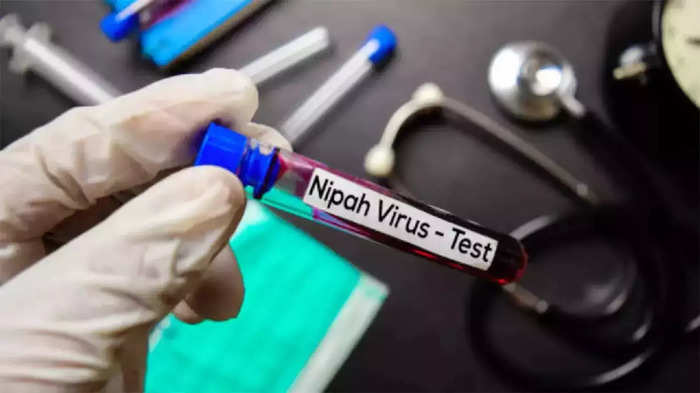 nipah virus