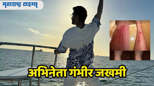 Arjun Bijlani: कुटुंबासोबत गोव्याला फिरायला गेलेल्या अभिनेत्याचा अपघात, जखमी पाय पाहून चाहते चिंतेत