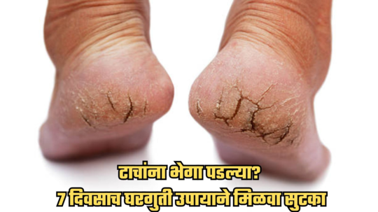 How to heal cracked heels: टाचांच्या भेगा बेडशीटमध्ये अडकून असह्य वेदना होतात? घरगुती उपायाने मिळवा सुटका