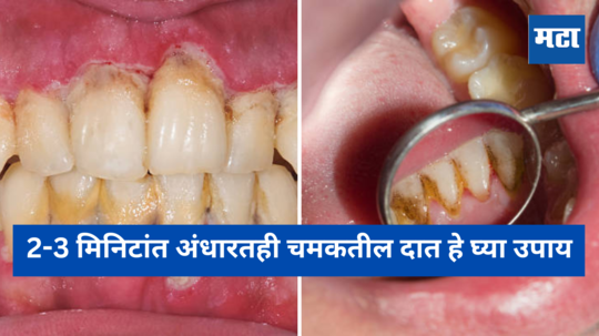 Teeth Whitening : घरगुती उपायांनी दातांवरील पिवळा किळसवाणा थर करा झटक्यात कमी, 2-3 मिनिटांत अंधारातही चमकतील दात