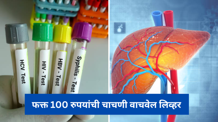 100 रुपयांची चाचणी वाचवेल लिव्हर, एम्सच्या डॉक्टरांनी सांगितले कोणी आणि कशी करावी टेस्ट