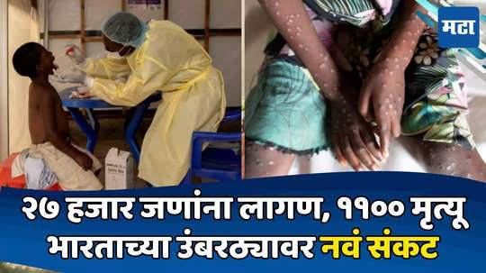 Mpox Virus: करोनानंतर नवं संकट! आफ्रिका, स्वीडननंतर पाकिस्तानात पोहोचला Mpox विषाणू, जाणून घ्या लक्षणं