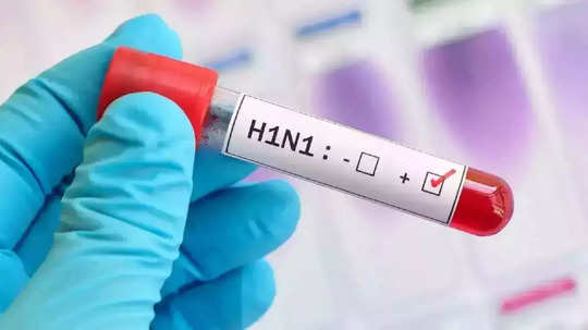 Swine Flu: काळजी घ्या! राज्यात ९ महिन्यांत स्वाइन फ्लूने ४६ मृत्यू; 'या' जिल्ह्यात सर्वाधिक प्रमाण, जाणून घ्या लक्षणं