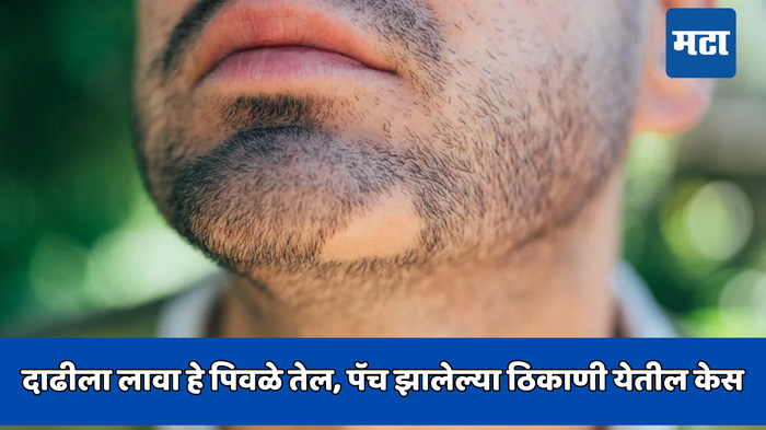 Beard Growth Oil : दाढीला लावा हे पिवळे तेल, पॅच झालेल्या ठिकाणी येतील केस, १५ दिवसात दिसेल परिणाम