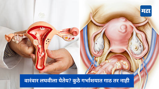 वारंवार लघवीला येतेय? कुठे गर्भाशयात गाठ तर नाही, आजच डॉक्टरांकडे जा