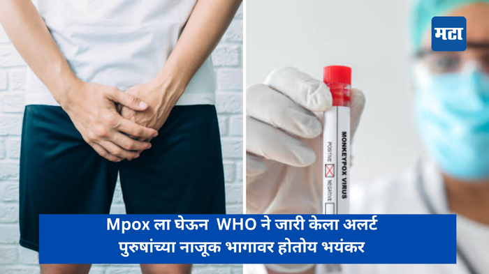 Mpox ला घेऊन  WHO ने जारी केला अलर्ट, पुरुषांच्या नाजूक भागावर होतोय भयंकर