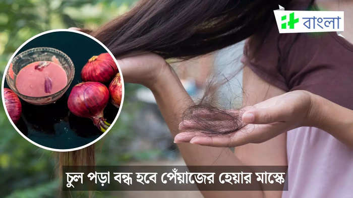 সপ্তাহে একদিন চুলে লাগান পেঁয়াজের এই হেয়ার মাস্ক, হেয়ার ফল কমবে অল্প দিনে