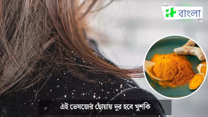 খুশকি দূর করতে হলুদ (ছবি সৌজন্যে: Istock)