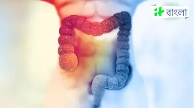 Kodak dokonlaridan porno suratlar