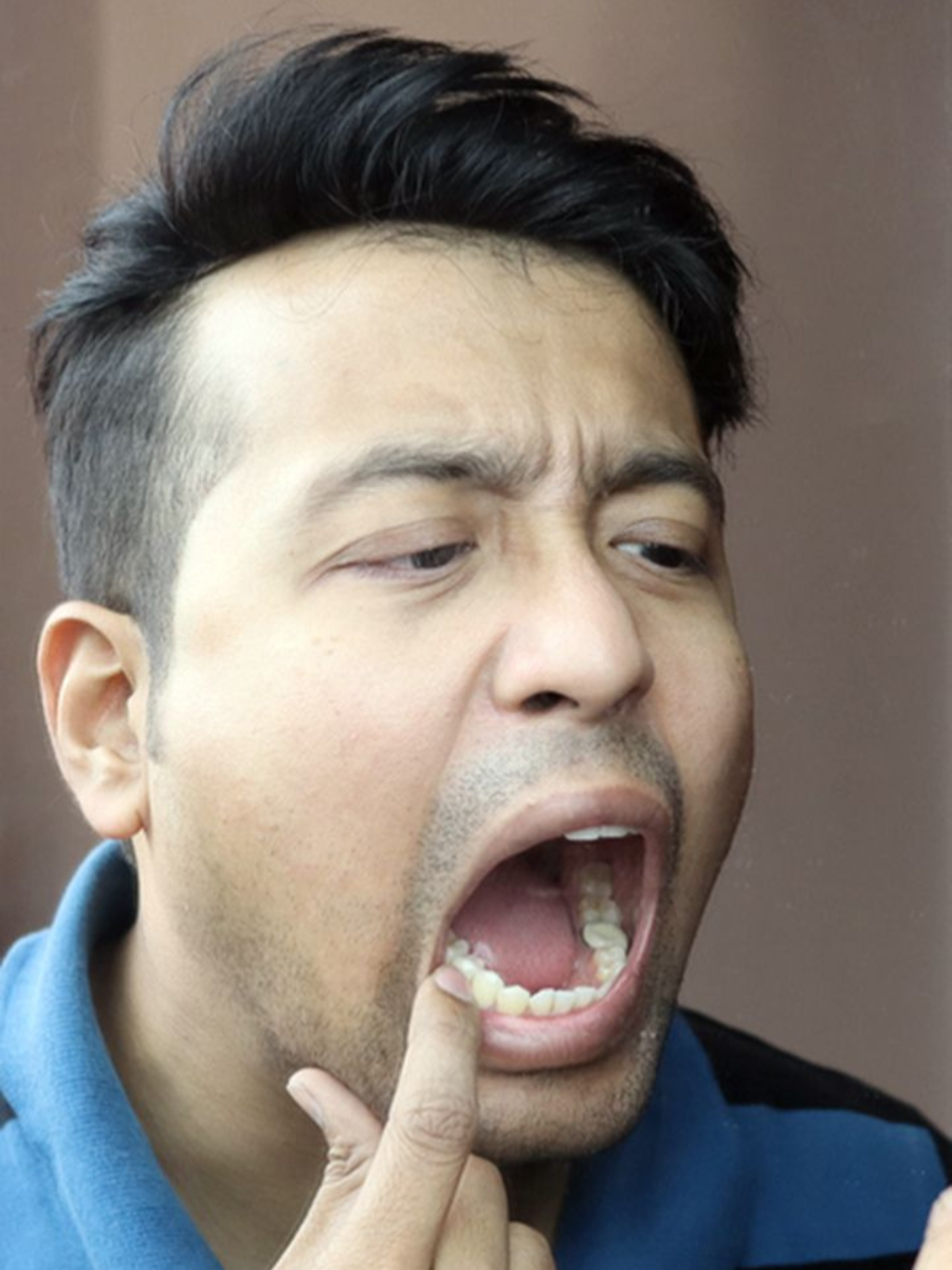 HEALTH - ShareChat