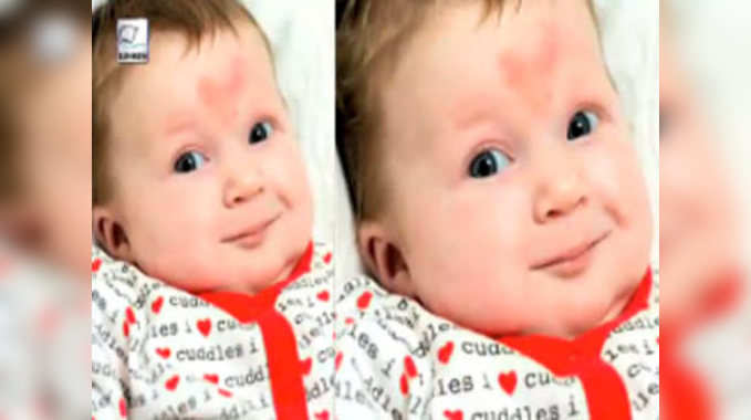 वेलेंटाइंस डे पर दिल के आकार के निशान के साथ पैदा हुई बच्ची 