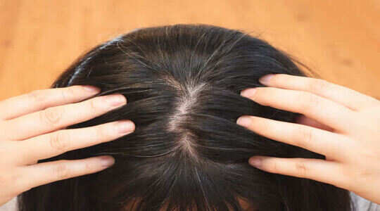 Gray Hair Causes White Hair Reasons ವಯಸ ಸ ಗ ಮ ನ ನ