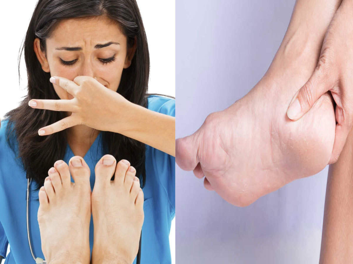 feet smell reason and treatment smelly feet - पैरों की बदबू से परेशान हैं तो कराना होगा दिमाग और पेट का इलाज - Navbharat Times