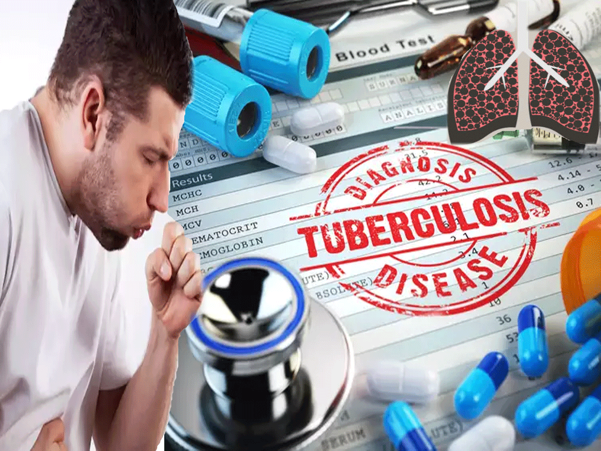 World TB Day 2020 - वर्ल्ड टीबी डे पर टीबी के बारे में जरूर पता होनी चाहिए ये 9 बातें - Navbharat Times