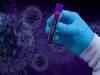 Coronavirus Latest Update : 69% मरीजों में नहीं कोरोना के लक्षण, 10 दिन तक नहीं आता बुखार तो कर दिए जाएंगे डिस्चार्ज Coronavirus Latest Update : 69% मरीजों में नहीं कोरोना के लक्षण, 10 दिन तक नहीं आता बुखार तो कर दिए जाएंगे डिस्चार्ज