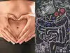 Stomach Ulcers: पेट में घाव दे सकती है यह छोटी-सी गलती, जानें बचाव के तरीके और इलाज 