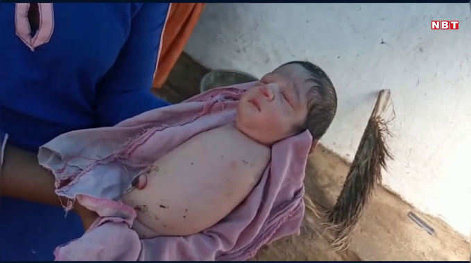 MP: विदिशा में हुआ यूनिक बच्ची का जन्म, देखने के लिए दूर-दूर से आ रहे हैं लोग 