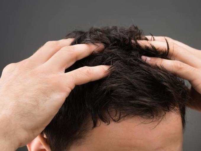 Natural Treatments for Hair Loss