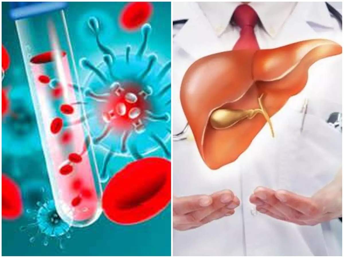 Kalleral Noigal இரத த பர ச தன ச ய த கல ல ரல ப த ப ப கண ட ப ட க க ம ட ய ம ம ட ய த உண ம என ன Blood Tests Can Predict Risk Of Severe Liver Disease In Tamil Samayam Tamil