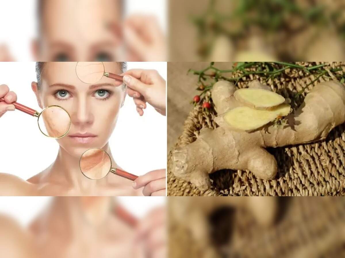 how to get acne by using ginger: இளமையா, அழகா, முகப்பரு இல்லாத முகத்துக்கு இஞ்சியே போதும் ஆனா இப்படிதான் யூஸ் பண்ணனும்! - benefits and uses of ginger for clear skin in tamil ...