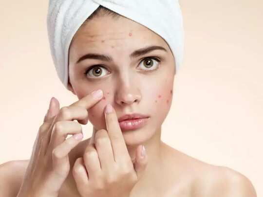 how to get acne by using ginger: இளமையா, அழகா, முகப்பரு இல்லாத முகத்துக்கு இஞ்சியே போதும் ஆனா இப்படிதான் யூஸ் பண்ணனும்! - benefits and uses of ginger for clear skin in tamil ...