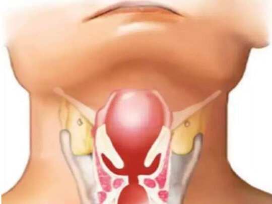 what is tonsillitis: டான்சில் என்னும் உள்நாக்கு அழற்சி யாருக்கெல்லாம் வரலாம், எப்படி தடுப்பது? - tonsillitis causes symptoms treatment and prevention | Samayam Tamil