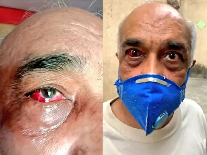 हमले में घायल नौसेना के पूर्व अधिकारी मदन शर्मा