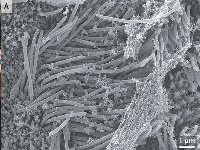 coronavirus in human cells