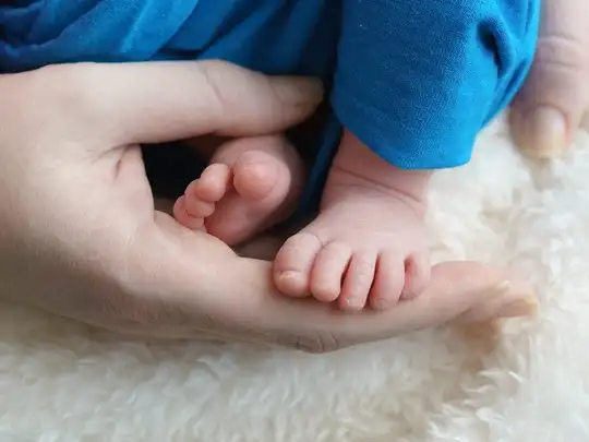 Clubfoot Symptoms Causes Risk Factors Treatment प द ह न क ब द स ह ट ढ ह बच च क प र क य सच म स भव ह इस ब म र क इल ज
