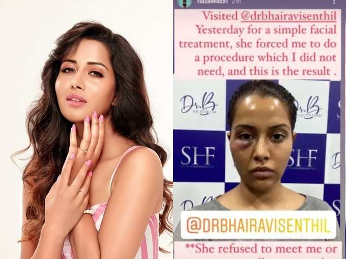 Raiza Wilson: The heroine who went to the clinic for a facial. Bigg Boss Beauty Revealed By Doctor Management - actress raiza wilson says about her face surgical procedure failure - R