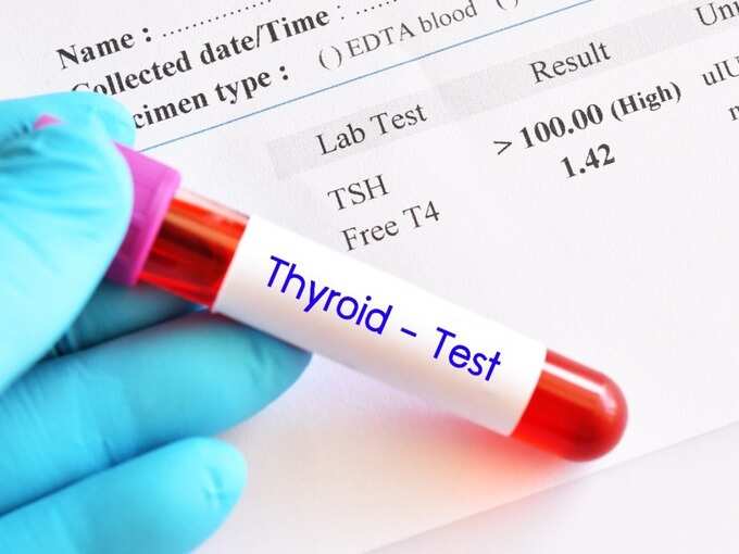 Thyroid test How to check thyroid patients in their test report, know