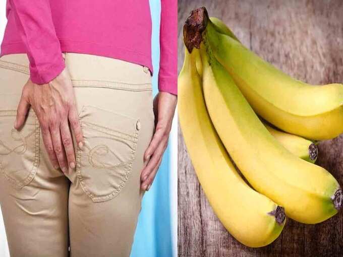 natural remedies for piles: மூல நோய் ஆரம்ப நிலையா, இதையெல்லாம் செய்தா குணப்படுத்திடலாம்! - simple home remedies to get rid of piles at home 9 samayam tamil Tamil News Spot