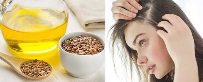 how to get rid of scalp pain: உச்சந்தலை அரிப்பு, அதீத வலி இந்த அஞ்சுல ஒரு எண்ணெய் யூஸ் பண்ணுங்க! எல்லோருமே செய்யலாம்! - best oil to cure scalp pain at home in tamil 5 samayam tamil Tamil News Spot