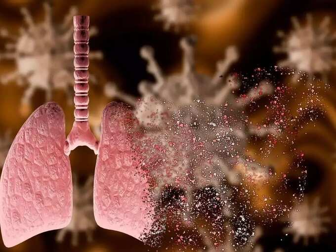Coronavirus and Pneumonia: கொரோனா நோயாளிகளுக்கு நிமோனியா, அறிகுறிகள், ஆபத்துகள், தீர்வுகள், தவிர்க்கும் வழிமுறைகள்! - does pneumonia attack for covid tested positive people 3 samayam tamil Tamil News Spot