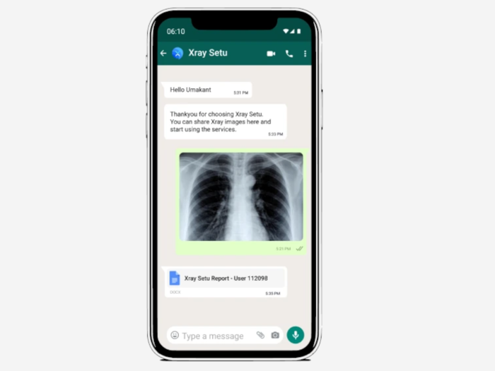 XraySetu service via WhatsApp: New AI-driven platform will help intervention of COVID-19 with help of Chest X-ray interpretation on WhatsApp. 