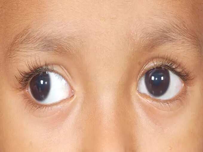 omega 3 fatty acid for kids: ஒமேகா 3 கொழுப்பு அமிலங்கள் : குழந்தைக்கு தரும் நன்மைகள், எதில் உண்டு, எவ்வளவு கொடுக்கலாம்! - benefits of omega 3 fatty acids for children in tamil 3 samayam tamil Tamil News Spot