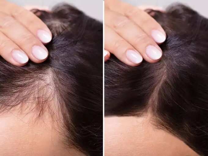 what are the side effects of hair straightening: கூந்தல் அழகா இருக்க ஹேர் ஸ்ட்ரெட்னிங் செய்ய போறீங்களா? பக்கவிளைவும் அதை தடுக்கும் முறையும்! - unknown side effects of hair straightening 8 samayam tamil Tamil News Spot