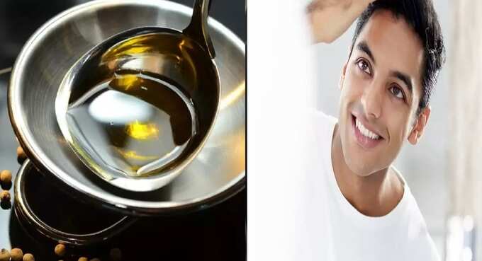 baldness treatment for men: ஆண்கள் தலைமுடி : சொட்டையை தடுக்கும் பாரம்பரிய வைத்தியம், நிச்சயம் பலன் உண்டு! - traditional treatment to prevent baldness for men 7 samayam tamil Tamil News Spot