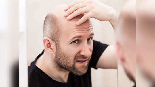 <strong>Baldness in men</strong><strong> :</strong>‘या’ ६ गंभीर चुकांमुळे पुरूषांचे तरूण वयातच पडते टक्कल! डॉक्टरांनी सांगितले हे उपाय! 