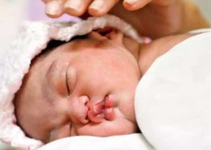 swollen eyes in babies: குழந்தைங்க கண்ணு வீங்கறது ஆபத்தா ? என்ன காரணம் ? வீட்டு வைத்தியம் உண்டா? 4 samayam tamil Tamil News Spot