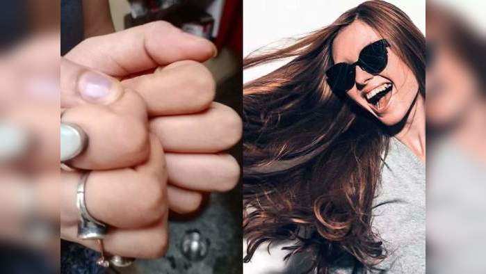 Nail rubbing : केसगळती व सफेद झालेल्या केसांसाठी 'हा' उपाय आहे रामबाण, पण या लोकांसाठी ठरू शकतो खतरनाक! 